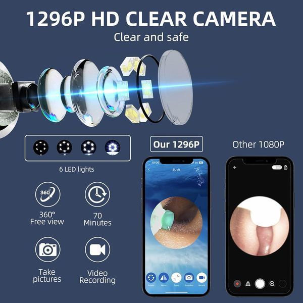 Набір для видалення вушної сірки з  LED-камерою для iOS та Android T1636 фото
