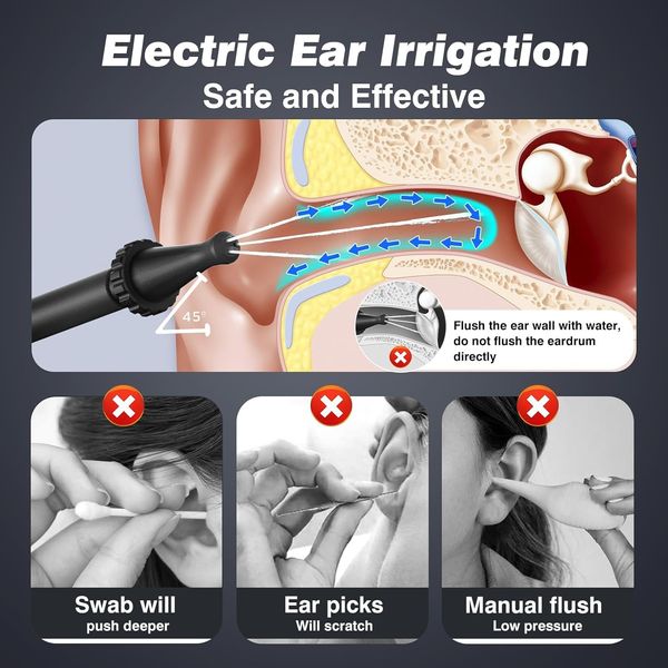 Електричний набір для чищення вух, засіб для видалення вушної сірки, 4 режими тиску 1415 фото