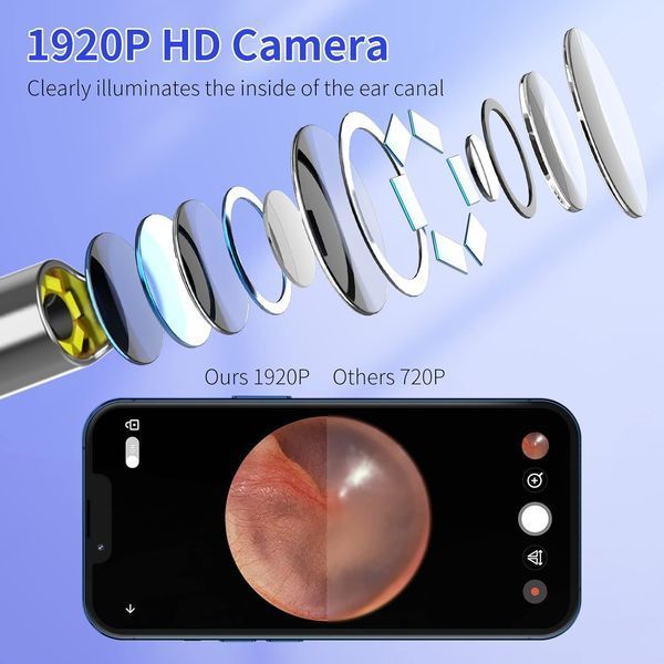 Пристрій для видалення вушної сірки 1920P T2453 фото